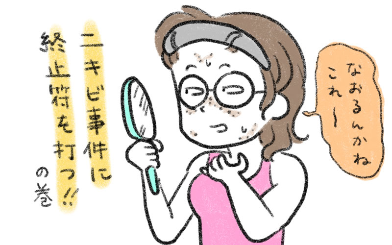 エステサロンで光フォトフェイシャルをした話。